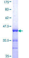 FKBP10 / FKBP65 Protein - 12.5% SDS-PAGE Stained with Coomassie Blue.