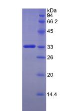 FKBP10 / FKBP65 Protein - Recombinant FK506 Binding Protein 10 By SDS-PAGE