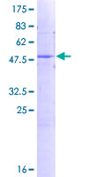 FKBP11 Protein - 12.5% SDS-PAGE of human FKBP11 stained with Coomassie Blue