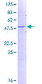 FKBP11 Protein - 12.5% SDS-PAGE of human FKBP11 stained with Coomassie Blue
