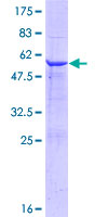 FKBP14 Protein - 12.5% SDS-PAGE of human FKBP14 stained with Coomassie Blue