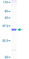 FKBP1A / FKBP12 Protein - 12.5% SDS-PAGE of human FKBP1A stained with Coomassie Blue