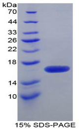 FKBP1B / FKBP12.6 Protein - Recombinant FK506 Binding Protein 1B By SDS-PAGE