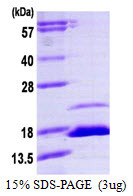 FKBP1B / FKBP12.6 Protein