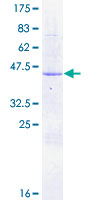 FKBP2 Protein - 12.5% SDS-PAGE of human FKBP2 stained with Coomassie Blue