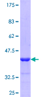 FKBP2 Protein - 12.5% SDS-PAGE Stained with Coomassie Blue.