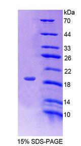 FKBP2 Protein - Recombinant FK506 Binding Protein 2 By SDS-PAGE