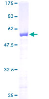 FKBP25 / FKBP3 Protein - 12.5% SDS-PAGE of human FKBP3 stained with Coomassie Blue