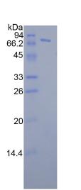 FKBP5 / FKBP51 Protein - Recombinant FK506 Binding Protein 5 By SDS-PAGE
