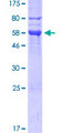 FKBP6 Protein - 12.5% SDS-PAGE of human FKBP6 stained with Coomassie Blue