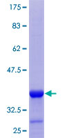 FKBP7 Protein - 12.5% SDS-PAGE Stained with Coomassie Blue.