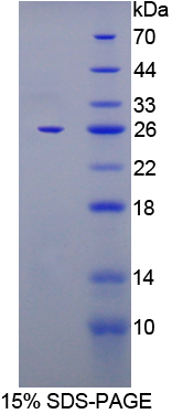 FKBP7 Protein - Recombinant  FK506 Binding Protein 7 By SDS-PAGE