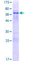 FKBPL Protein - 12.5% SDS-PAGE of human FKBPL stained with Coomassie Blue