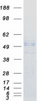 FKRP Protein - Purified recombinant protein FKRP was analyzed by SDS-PAGE gel and Coomassie Blue Staining