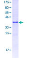 FKSG80 / GPR81 Protein - 12.5% SDS-PAGE Stained with Coomassie Blue.