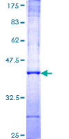 FKTN / Fukutin Protein - 12.5% SDS-PAGE Stained with Coomassie Blue.