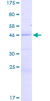 FLAME-3 / DEDD2 Protein - 12.5% SDS-PAGE of human DEDD2 stained with Coomassie Blue
