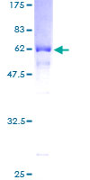 FLCN / Folliculin Protein - 12.5% SDS-PAGE of human FLCN stained with Coomassie Blue