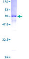 FLCN / Folliculin Protein - 12.5% SDS-PAGE of human FLCN stained with Coomassie Blue