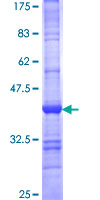 FLCN / Folliculin Protein - 12.5% SDS-PAGE Stained with Coomassie Blue.