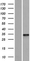 FLJ11286 Protein - Western validation with an anti-DDK antibody * L: Control HEK293 lysate R: Over-expression lysate
