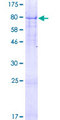 FLJ12529 / CPSF7 Protein - 12.5% SDS-PAGE of human FLJ12529 stained with Coomassie Blue