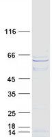 FLJ12529 / CPSF7 Protein - Purified recombinant protein CPSF7 was analyzed by SDS-PAGE gel and Coomassie Blue Staining
