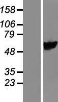 FLJ22028 Protein - Western validation with an anti-DDK antibody * L: Control HEK293 lysate R: Over-expression lysate