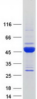 FLJ43980 Protein - Purified recombinant protein FLJ43980 was analyzed by SDS-PAGE gel and Coomassie Blue Staining