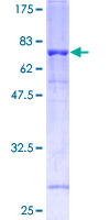 FLOT1 / Flotillin 1 Protein - 12.5% SDS-PAGE of human FLOT1 stained with Coomassie Blue