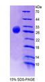 FLRT2 Protein - Recombinant Fibronectin Leucine Rich Transmembrane Protein 2 By SDS-PAGE