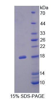 FLRT3 Protein - Recombinant  Fibronectin Leucine Rich Transmembrane Protein 3 By SDS-PAGE