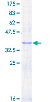 FLT1 / VEGFR1 Protein - 12.5% SDS-PAGE Stained with Coomassie Blue.
