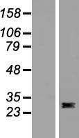 FLT3LG / Flt3 Ligand Protein - Western validation with an anti-DDK antibody * L: Control HEK293 lysate R: Over-expression lysate