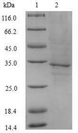 FLT3LG / Flt3 Ligand Protein - (Tris-Glycine gel) Discontinuous SDS-PAGE (reduced) with 5% enrichment gel and 15% separation gel.