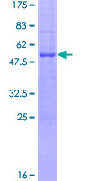 FLT3LG / Flt3 Ligand Protein - 12.5% SDS-PAGE of human FLT3LG stained with Coomassie Blue