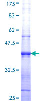 FLT3LG / Flt3 Ligand Protein - 12.5% SDS-PAGE Stained with Coomassie Blue.