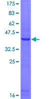 FLT4 / VEGFR3 Protein - 12.5% SDS-PAGE Stained with Coomassie Blue.