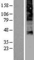 FLVCR / FLVCR1 Protein - Western validation with an anti-DDK antibody * L: Control HEK293 lysate R: Over-expression lysate