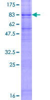 FLVCR / FLVCR1 Protein - 12.5% SDS-PAGE of human FLVCR stained with Coomassie Blue