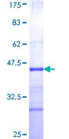FLVCR / FLVCR1 Protein - 12.5% SDS-PAGE Stained with Coomassie Blue.