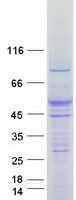 FLVCR2 Protein - Purified recombinant protein FLVCR2 was analyzed by SDS-PAGE gel and Coomassie Blue Staining