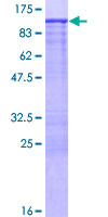 FMN1 Protein - 12.5% SDS-PAGE of human FMN1 stained with Coomassie Blue