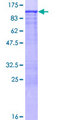 FMN1 Protein - 12.5% SDS-PAGE of human FMN1 stained with Coomassie Blue