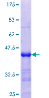 FMN1 Protein - 12.5% SDS-PAGE Stained with Coomassie Blue.