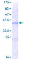 FMN2 / Formin 2 Protein - 12.5% SDS-PAGE Stained with Coomassie Blue