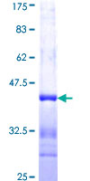 FMNL1 Protein - 12.5% SDS-PAGE Stained with Coomassie Blue.