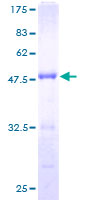 FMNL2 Protein - 12.5% SDS-PAGE of human FMNL2 stained with Coomassie Blue