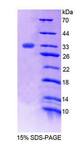FMO2 Protein - Recombinant Flavin Containing Monooxygenase 2, Non Functional By SDS-PAGE