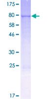 FMO3 Protein - 12.5% SDS-PAGE of human FMO3 stained with Coomassie Blue